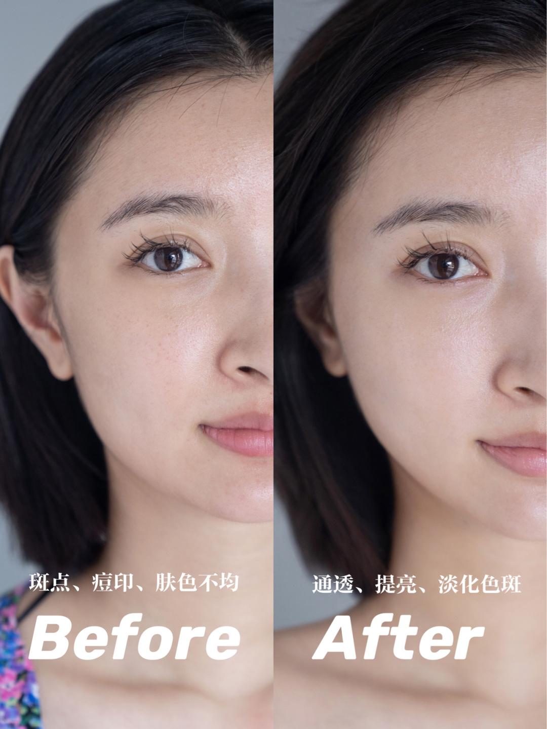 小灯泡与科颜氏淡斑测评,科颜氏去黄提亮效果怎么样