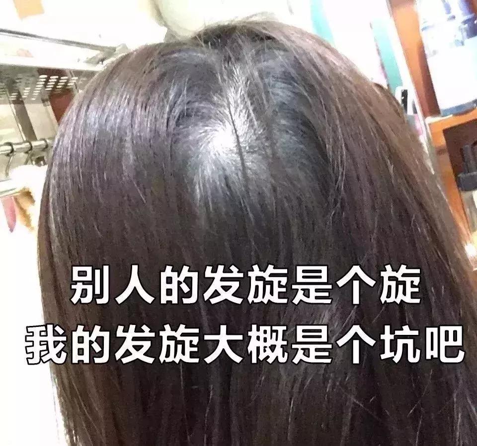 女人脱发,女性其实比男性秃
