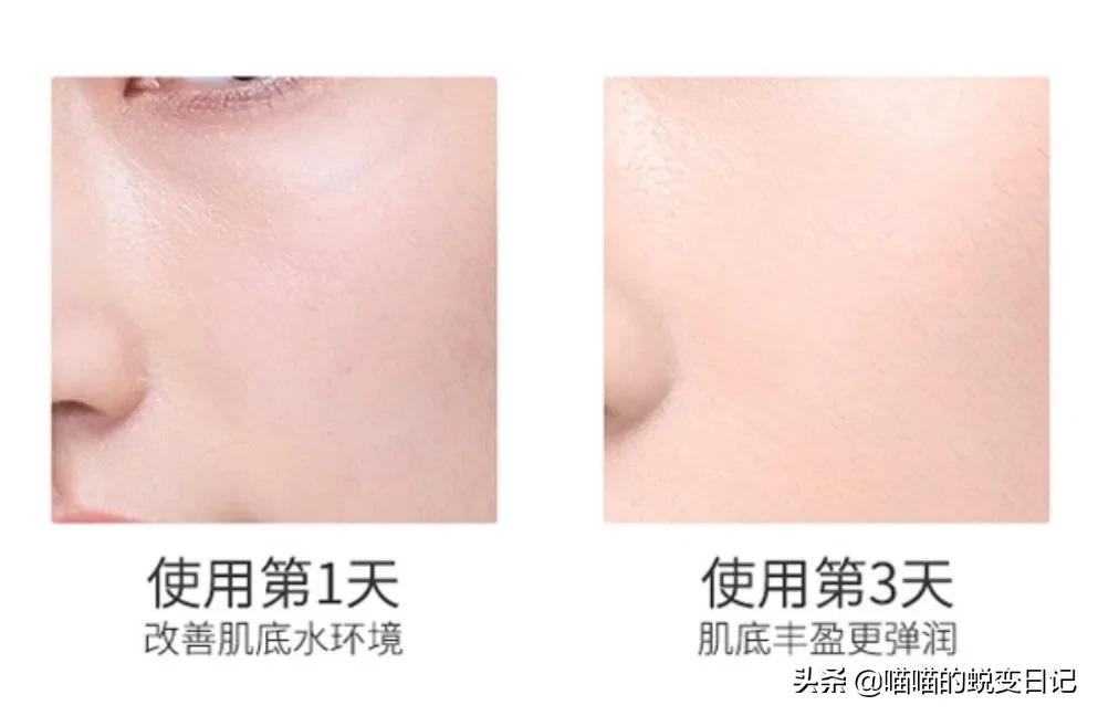 薇娅推荐+欧美国家断货，*麻大**CBD凭什么成为护肤网红成分扛把子？