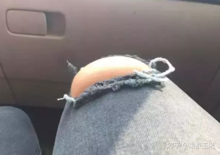 假胯宽、大象腿、脂肪腿,天生大粗腿的人该如何瘦大腿?