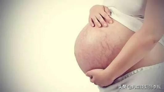孕妇私部瘙痒怎么清洗,孕妈外阴瘙痒该怎么办