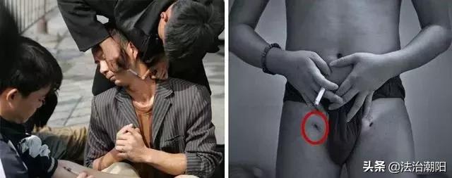 有一种玩命的吸毒方式叫“开天窗”,轻则致残,重则死亡