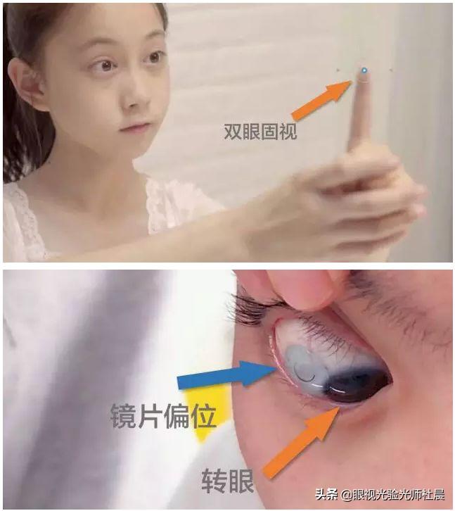 初次戴隐形眼镜感觉有点眩晕,初次戴隐形眼镜怎么取下来