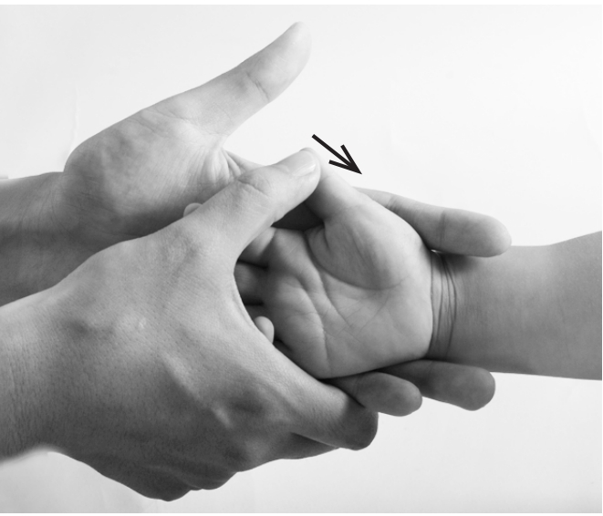 儿童感冒反复发烧怎么降烧,小孩反复发烧物理降温的正确方法