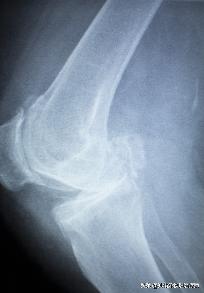 膝盖痛是什么病引起的怎么治,膝盖疼致病原因