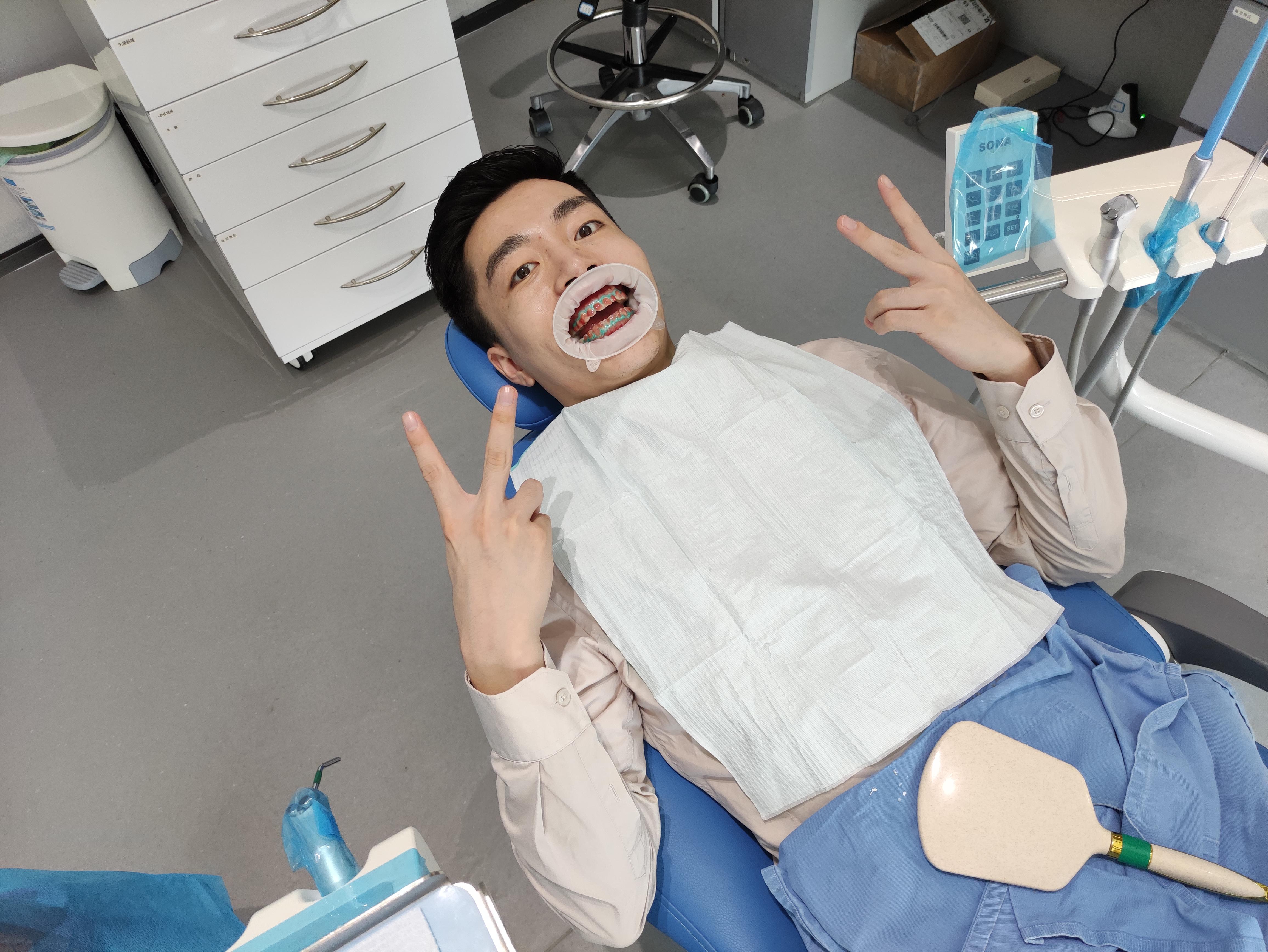 牙医的牙齿美白过程,医生推荐的牙齿美白