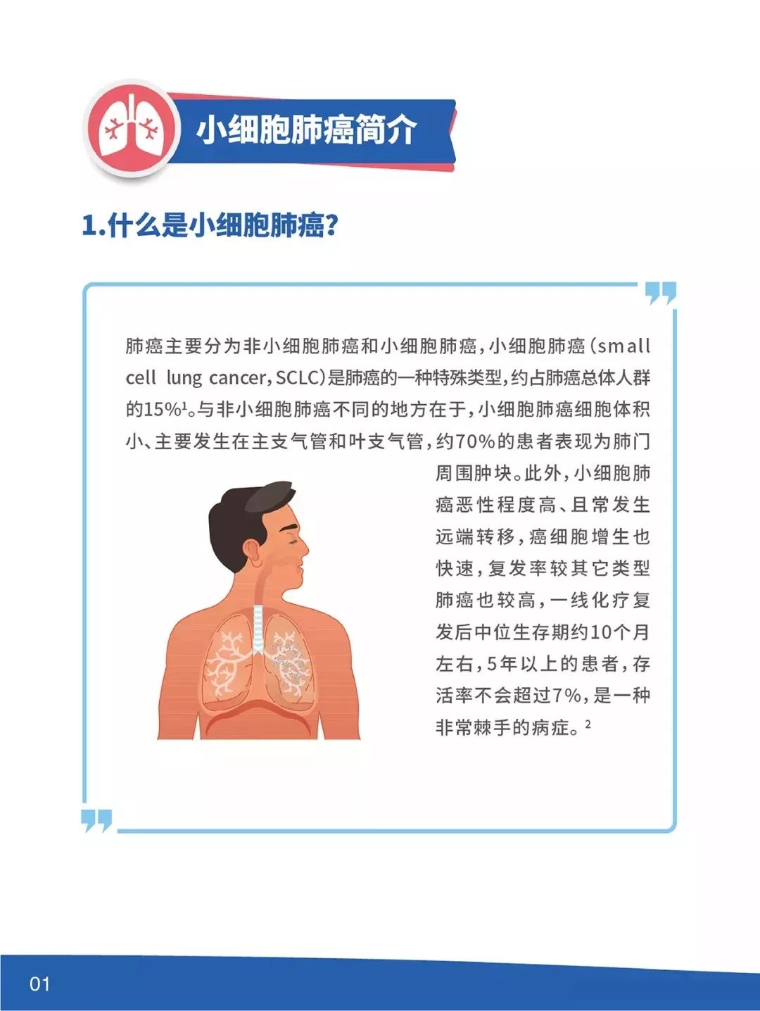 一文读懂小细胞肺癌
