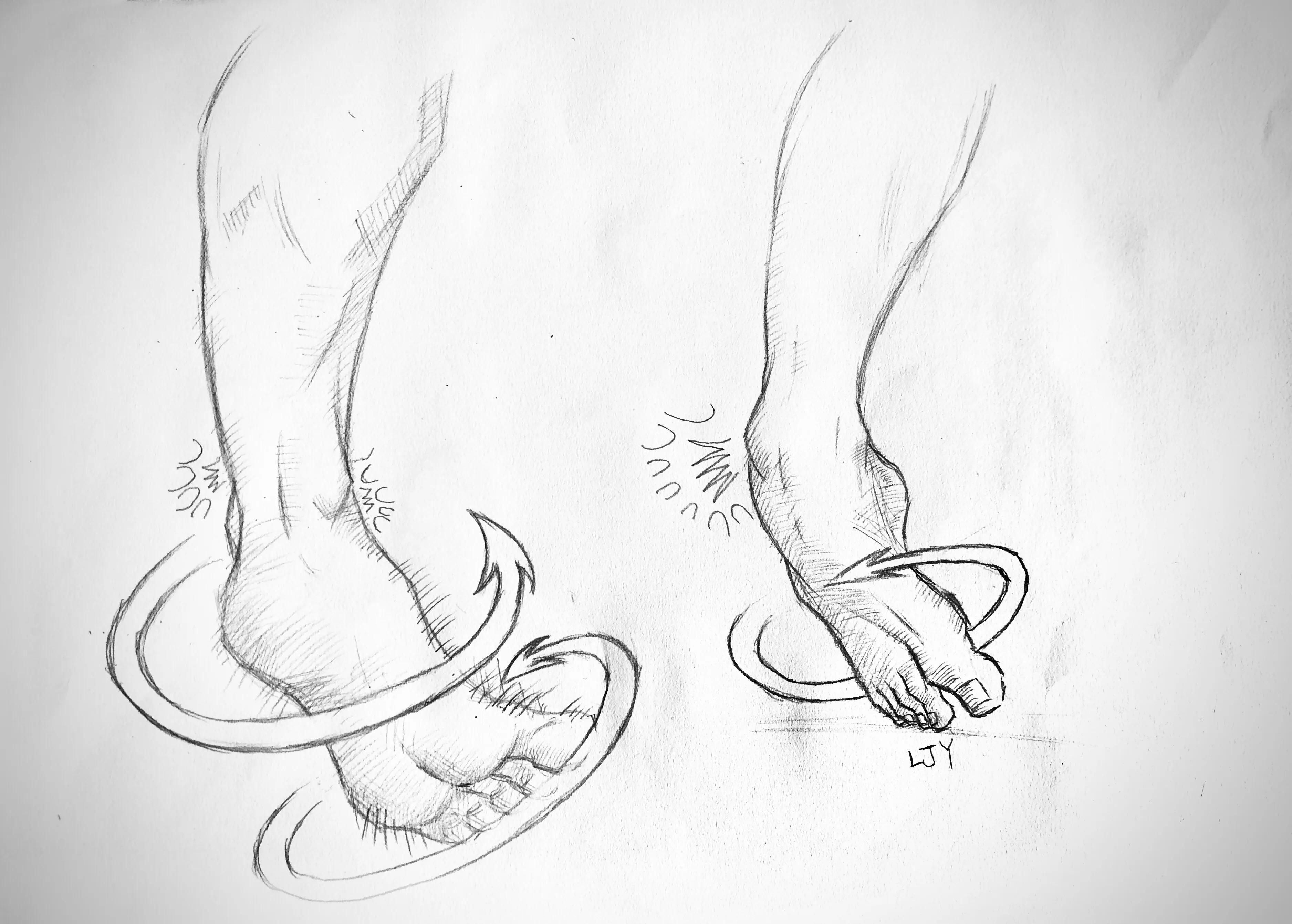 踝关节扭伤后有何表现,踝关节扭伤的自我判断与治疗