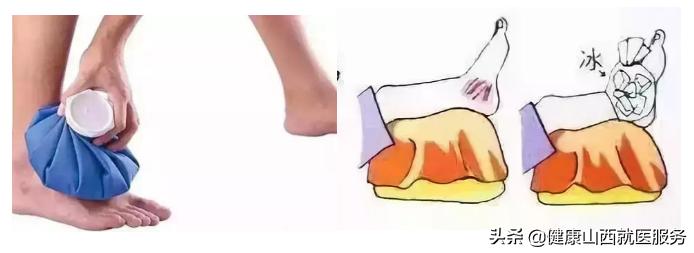 崴脚了要怎么护理牢记这4点,崴脚扭伤怎么好得更快一点