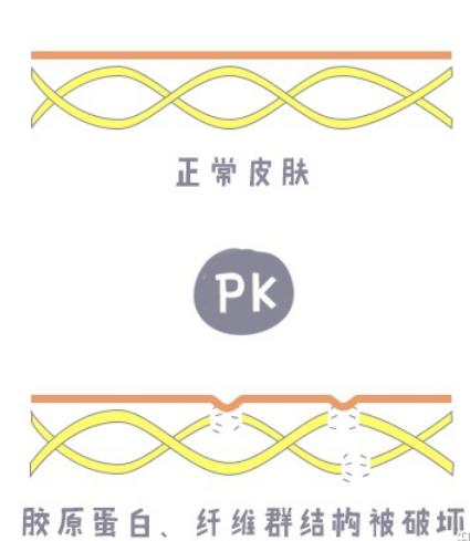 脸上干纹细纹多怎么办,怎样改善脸上的干纹和细纹