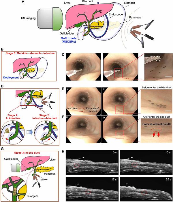 微型机器人和传统机器人结合实现体内狭小腔道的快速高精度递送