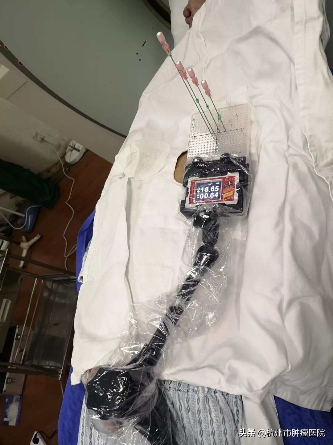 肿瘤医院ct三维重建图像多少钱,医院3d打印肿瘤模型