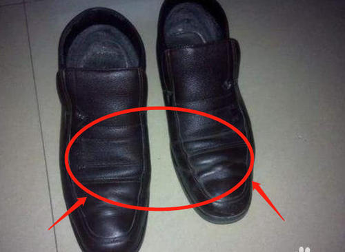 皮鞋有黑鞋印怎么办,怎么消除皮鞋的褶皱