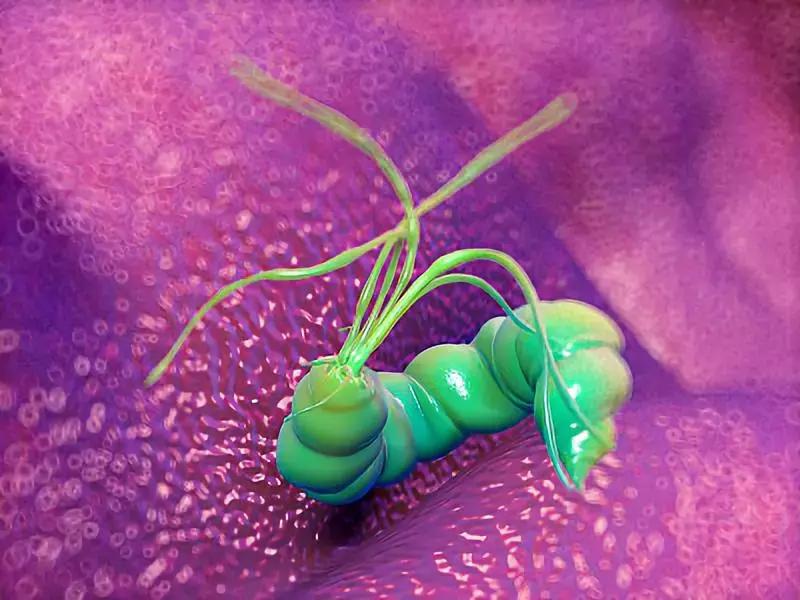 幽门螺杆菌有“好”,有“坏”?到底杀了好还是留下好?