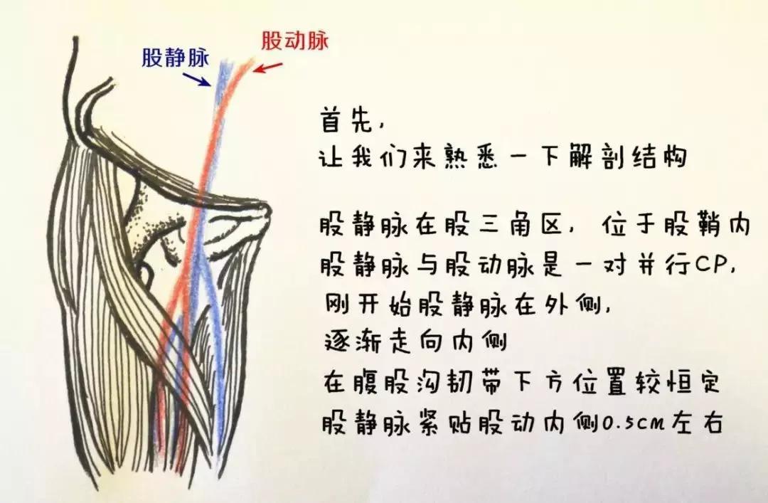 股静脉穿刺置管输液,股静脉穿刺置管术详细讲解