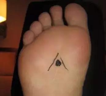 一病一绝招,治疗一病一穴奇效法