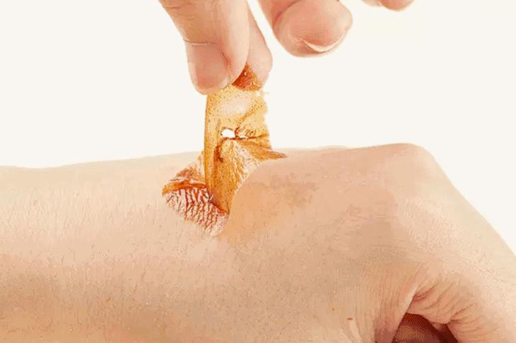 下巴凸起的颗粒怎么去除,下巴凸起小颗粒怎么消除