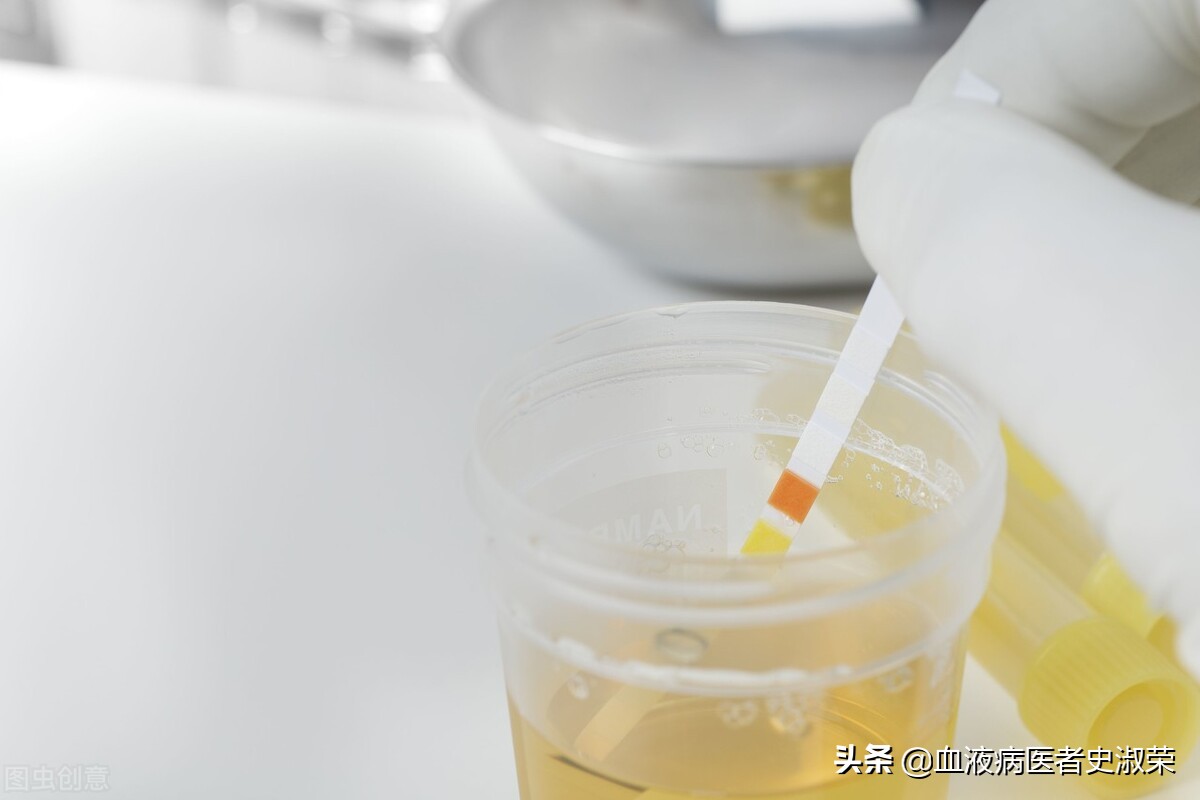 过敏性紫癜肾脏损害多久出现,过敏性紫癜反复发作会影响肾脏吗