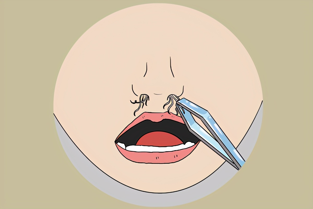 鼻毛变白是衰老的前兆吗,鼻毛变白是什么原因造成的