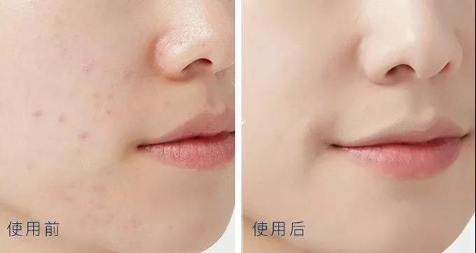 排雷护肤品测评,排雷好物推荐