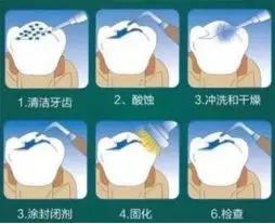 想要孩子牙齿好只用学会这几招,别让孩子颜值败在一口坏牙