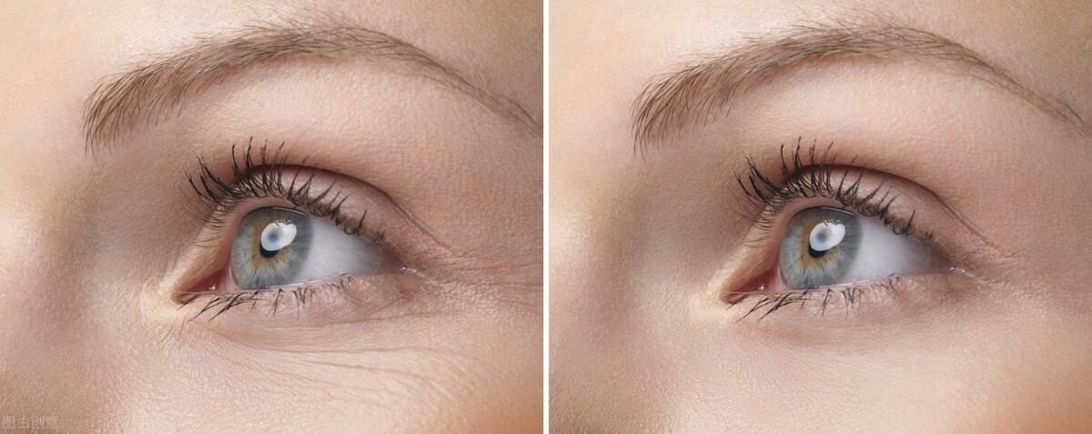 50岁改善眼部皱纹最有效的方法,有什么方法可以改善眼周皱纹