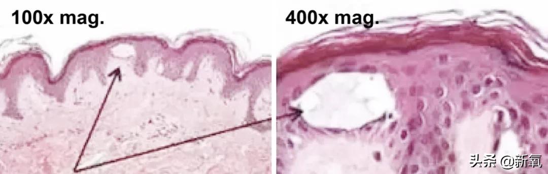 吴昕素颜真的很漂亮吗,吴昕为什么这么频繁上热搜