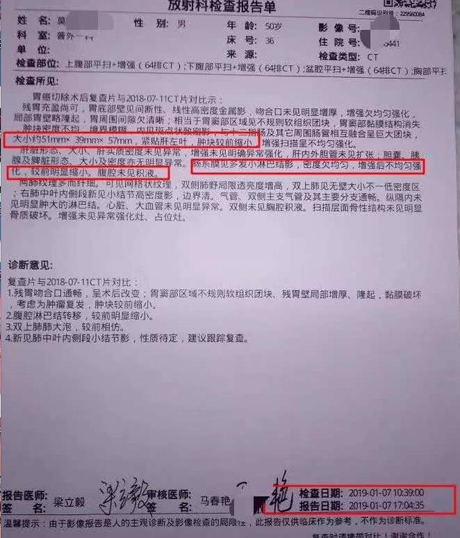 莫先生住院,胃癌手术患者术后恢复得挺好