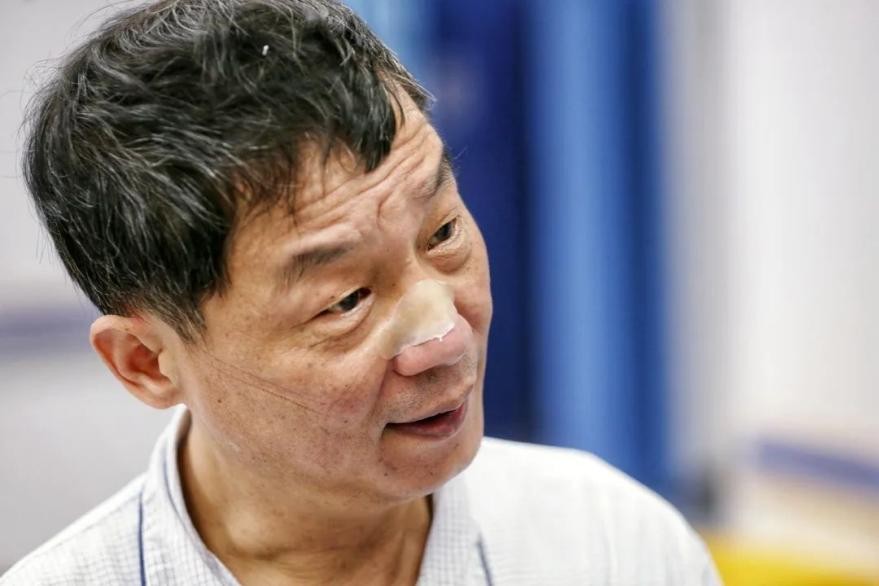 中国艾滋病治疗成功案例有多少,中国治好艾滋病第一个人