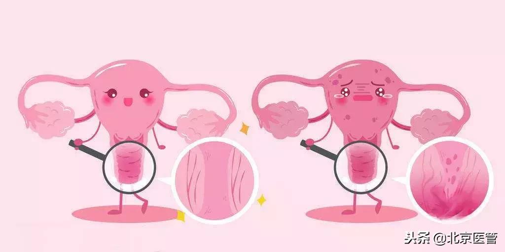 12岁少女患上妇科病,竟与这种畸形有关?肚子疼别忽视!