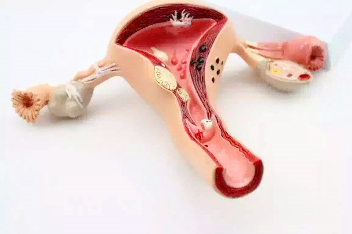 子宫摘除害处有哪些,女人摘除子宫和正常人的区别