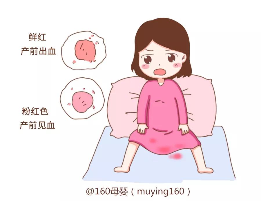 手术室产妇大出血抢救预案,产妇大出血导致胎儿轻微窒息