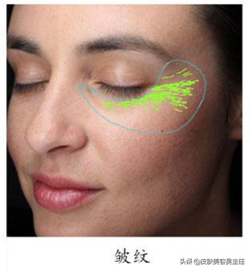 visia皮肤检测分高低吗,visia皮肤检测值多少是正常的