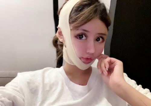 19岁少女因自己长得丑要去整容,13岁女孩变丑