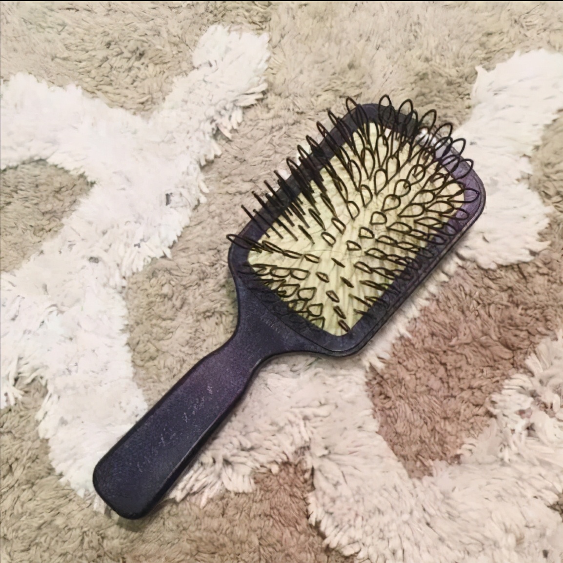 老年人头皮出油脱发是什么原因,脱发严重头皮痒怎么养发