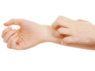 患银屑病应该多吃什么,银屑病和副银屑病怎么发作的