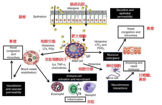 非过敏性鼻炎喷剂,非过敏性鼻炎的症状有哪些