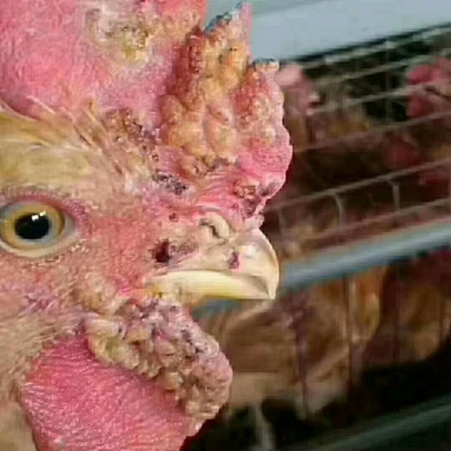 鸡眼睛长痘的最快治疗方法,人手上长鸡痘怎么治疗