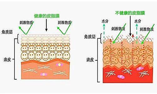 皮肤受损红肿怎么办,皮肤干痒红肿怎么急救