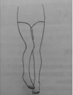 钱包越厚，屁股越痛？真的！它还有个医学名字