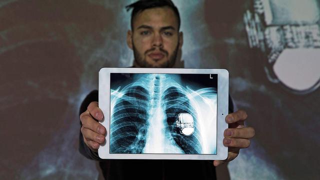 靠心脏起搏器持续足球梦想，现实版“钢铁侠”渴望执教德甲