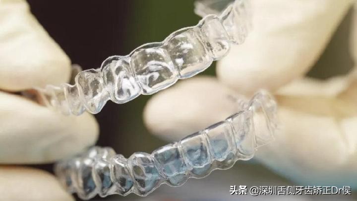 保持器怎么做微调,保持器该怎么选