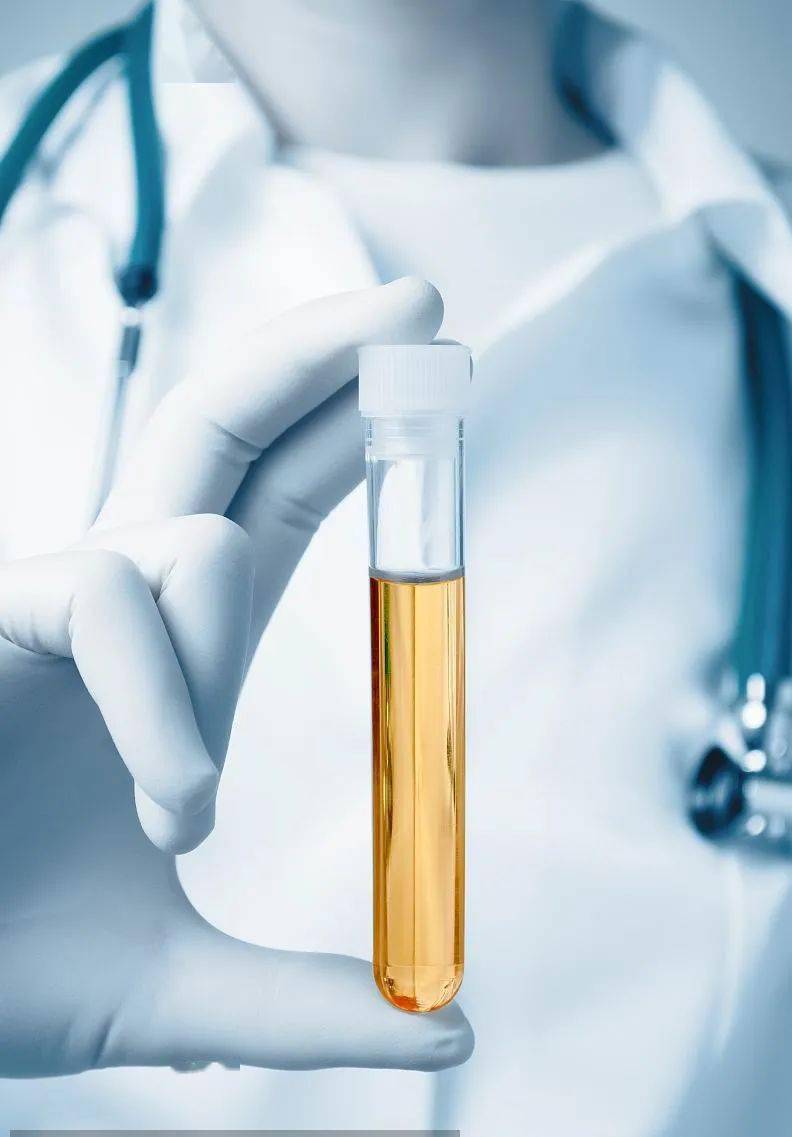 高鸟氨酸血症是什么意思,高鸟氨酸血症有什么症状新生儿