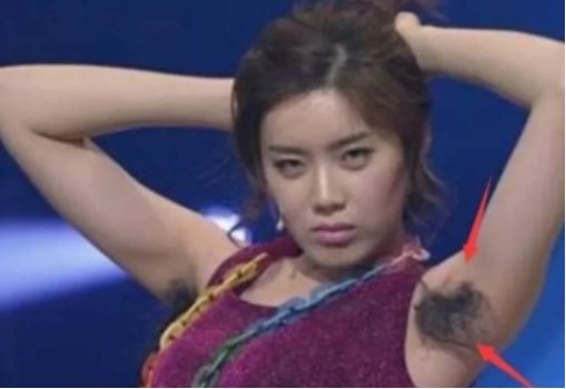 为什么有的女生腋下不黑,为什么有的女人腋下不长汗毛