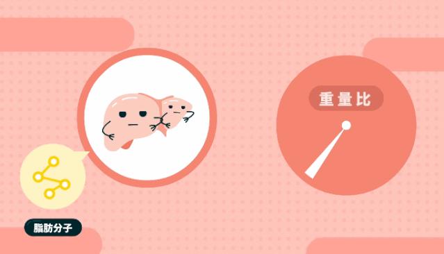 体检查出脂肪肝转氨酶100算不算高,体检查出脂肪肝影响录取吗