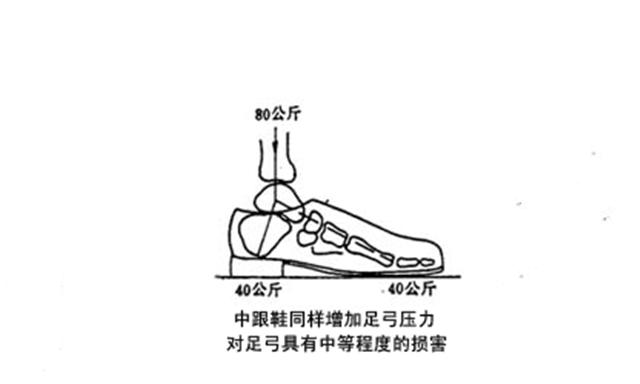 穿哪种鞋子更容易得扁平足,扁平足穿鞋难看怎么办