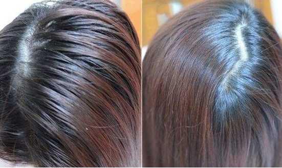 去头屑国产洗发水,什么牌子的洗发水去头屑好用