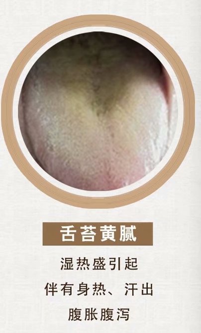 舌诊脉诊分析合集,舌诊实战分析