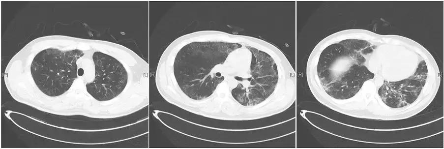 娴佹劅棰勯槻寰佹枃,娴佹劅棰勯槻鐨勫緛鏂囩
