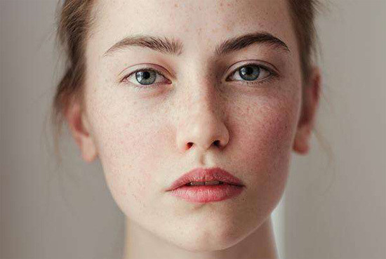 长斑饮食禁忌食物一览表,长斑要少吃什么食物